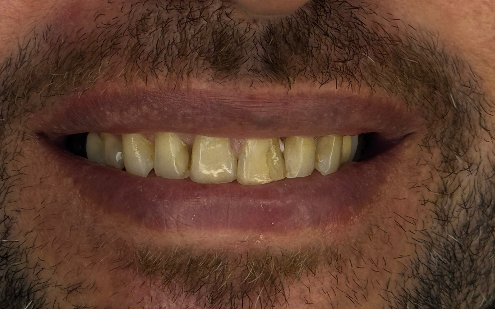5 5